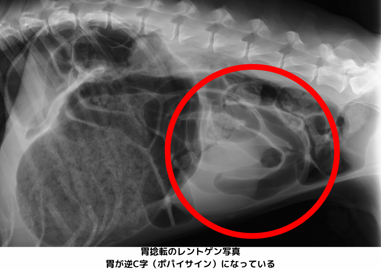 胃捻転のレントゲン写真。胃が逆C字（ポパイサイン）になっている様子が確認できる。